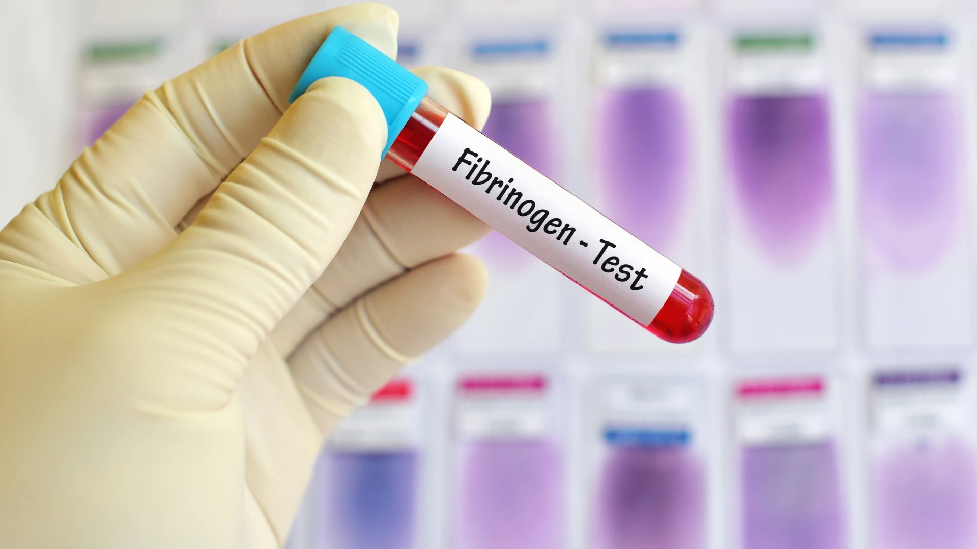Fibrinogen